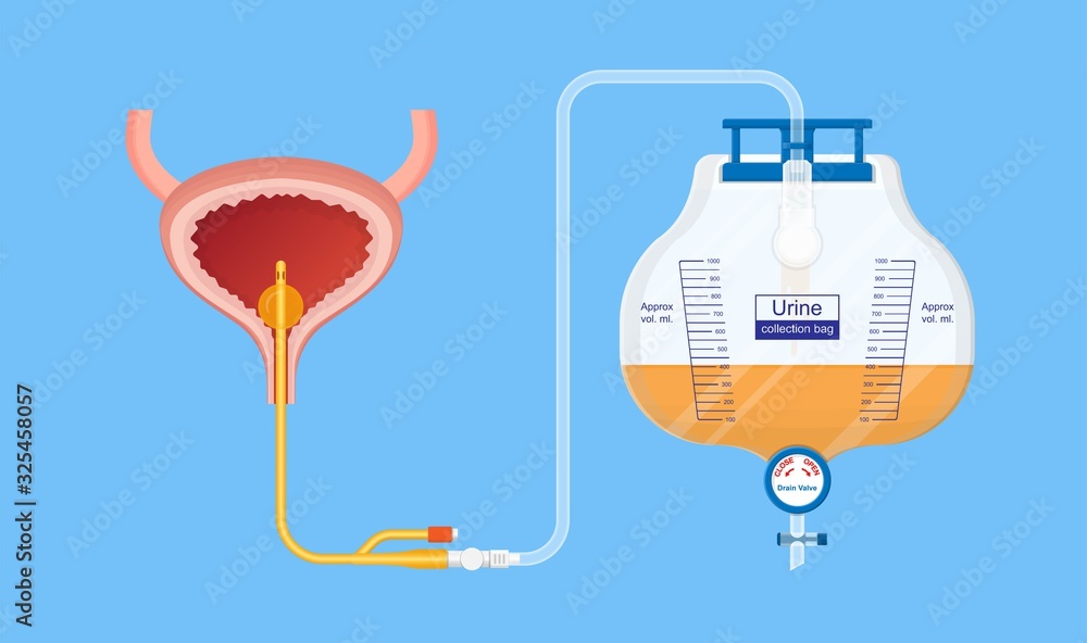 Urine bag medical treatment drainage bladder rubber flexible body