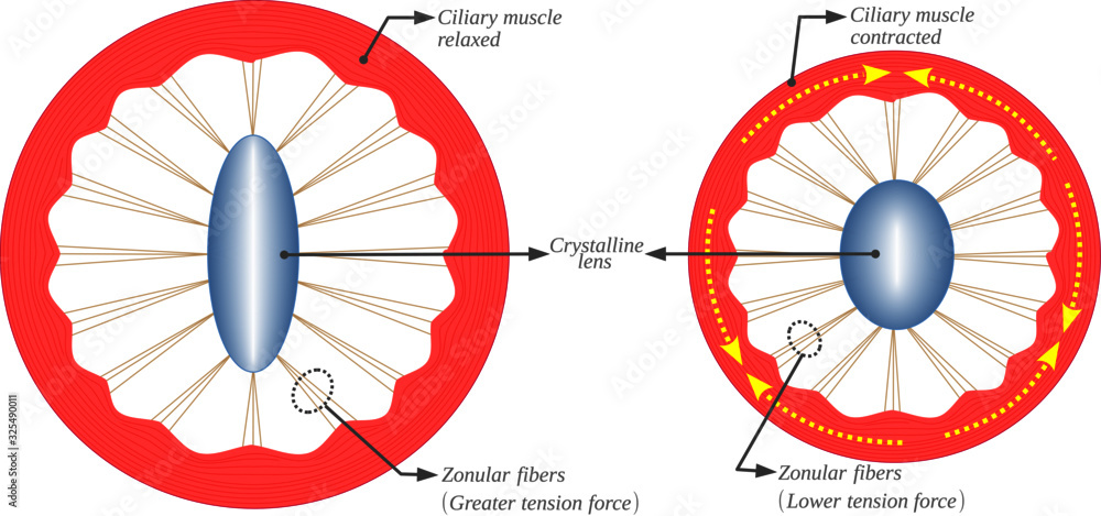 The accommodation of the crystalline lens is due to the contraction of the  ciliary muscles. This