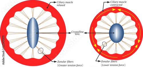 The accommodation of the crystalline lens is due to the contraction of the ciliary muscles. This results in the variation of the tension in the zonular fibers and the variation thickness of the lens.