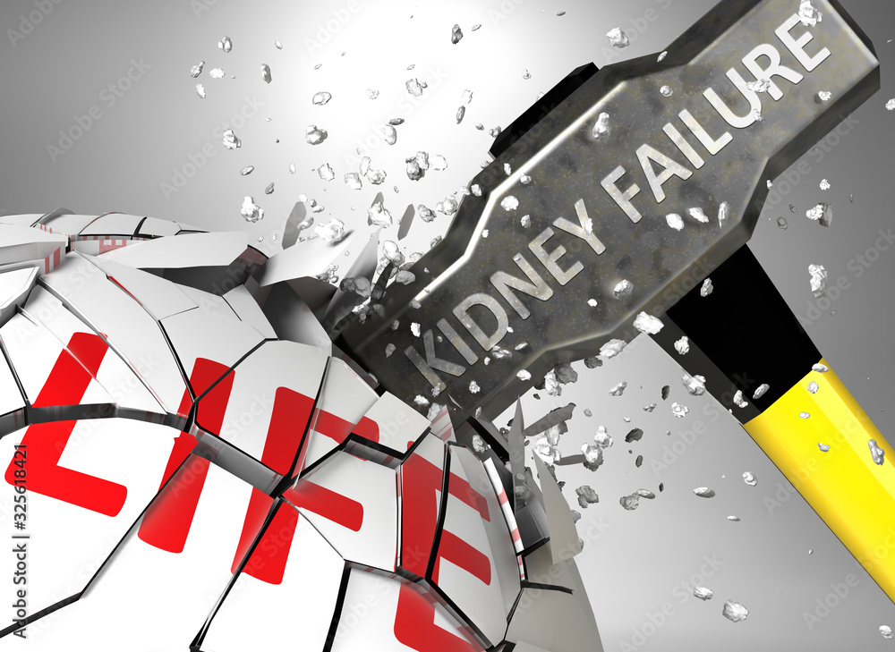 Plakat Kidney failure and destruction of health and life - symbolized by word Kidney failure and a hammer to show negative aspect of Kidney failure, 3d illustration