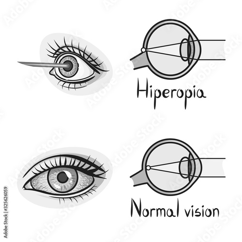 Vector illustration of vision and correction icon. Collection of vision and optometry vector icon for stock.