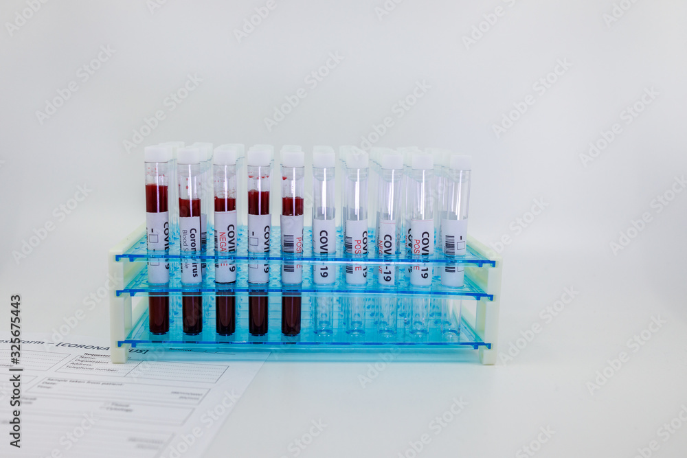 Test tubes rack with blood sample for coronavirus, covid-19 virus and empty tubes. Test form request and test blood tubes rack on white background with copy space.