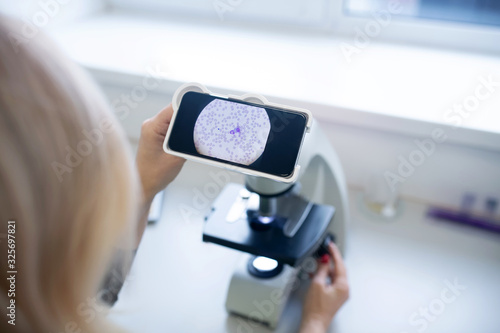 Close up of a test galss with sample for cytological analysis photo