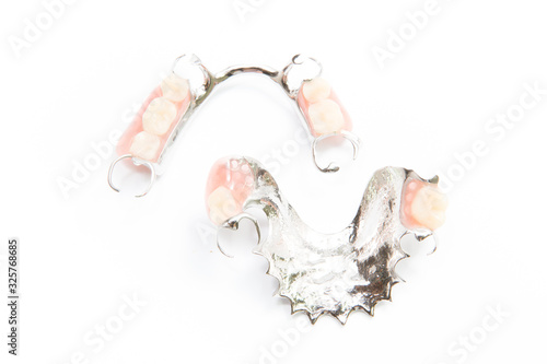 removable partial denture on white background.