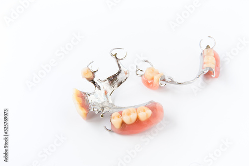 removable partial denture on white background.