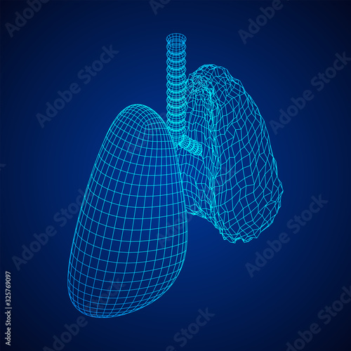 Healthy and sick lung with trachea bronchi internal organ human. Pulmonology medicine science technology concept. Wireframe low poly mesh vector illustration