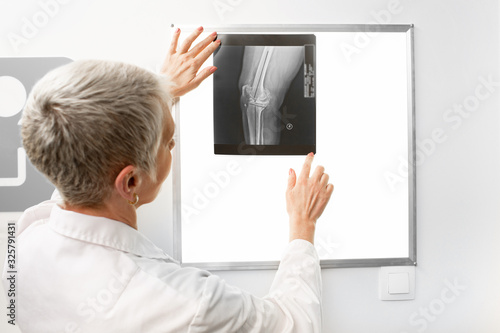 Mature doctor watching a knee x-ray on a negatoscope. Radiology photo