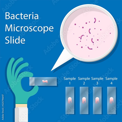 Scientist Holder Glass Microscope Slide with Hand for Examination in Laboratory Bacteria Diagnostic Disease diagnosis screen