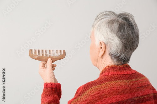 Senior woman with hair loss...