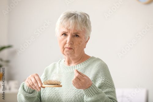 Senior woman with hair loss...