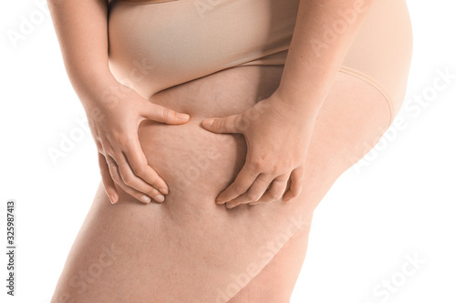 Overweight woman with cellulite problem on white background, closeup