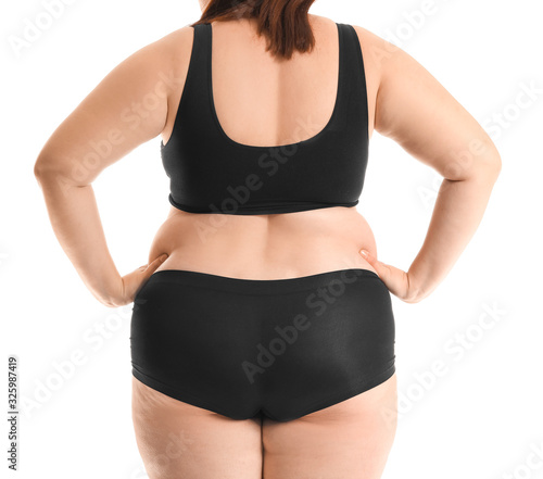 Overweight woman with cellu...