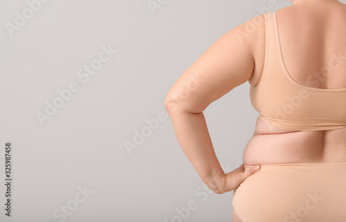 Overweight woman with cellulite problem on light background photo