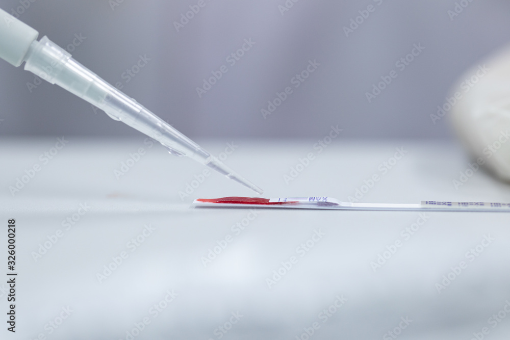 Study of Hepatitis-B Detection in laboratories. Study of Hepatitis-B Detection in laboratories.