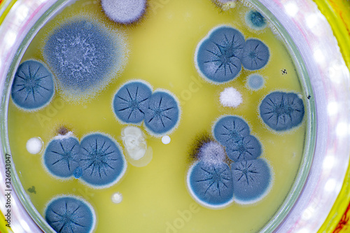 colony of skin fungi in a petri dish photo