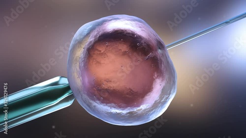 Artificial insemination or in vitro fertilization photo
