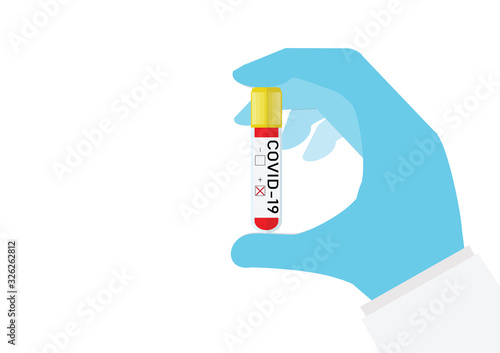 Hand holding test tube with blood sample for COVID-19 test.