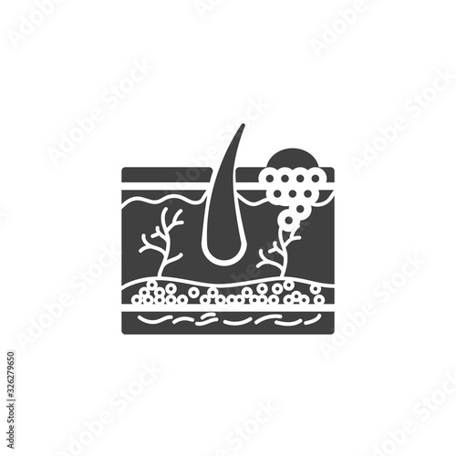 Melanoma skin cancer vector icon. filled flat sign for mobile concept and web design. Skin cancer glyph icon. Symbol, logo illustration. Vector graphics