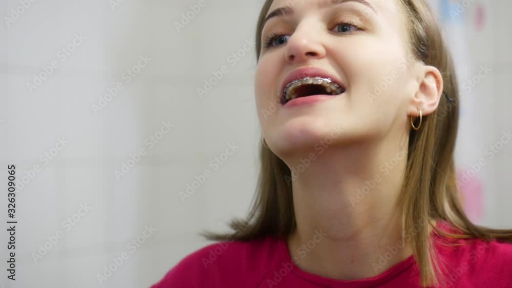 European girl looks in the mirror at her braces on her teeth European girl looks in the mirror at her braces on her teeth