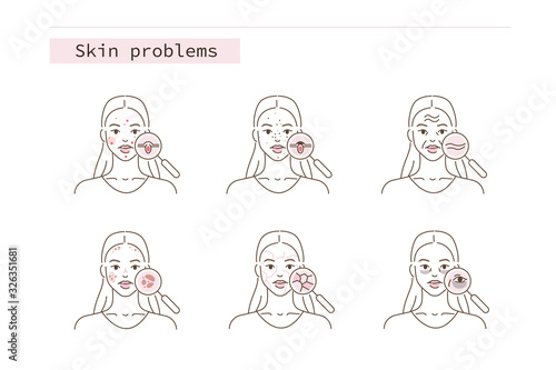 Beauty Girl Have Skin Problems. Acne, Wrinkles, Pigmentation, Dry Skin and Dark Spots.  Different Skin Conditions and Diseases. Flat Line Cartoon Vector Illustration.