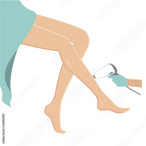 Female legs hair removal. Laser epilation concept, vector illustration