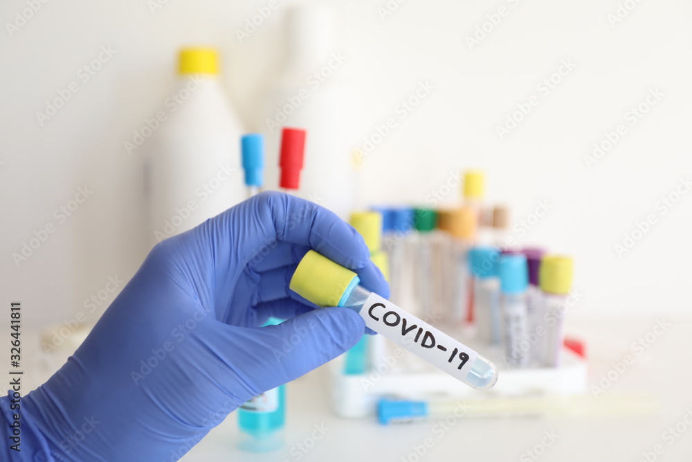 coronavirus covid-19 test tube in the laboratory