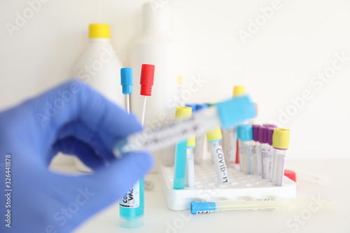 coronavirus flu - clinical tests on test tube samples for vaccine research