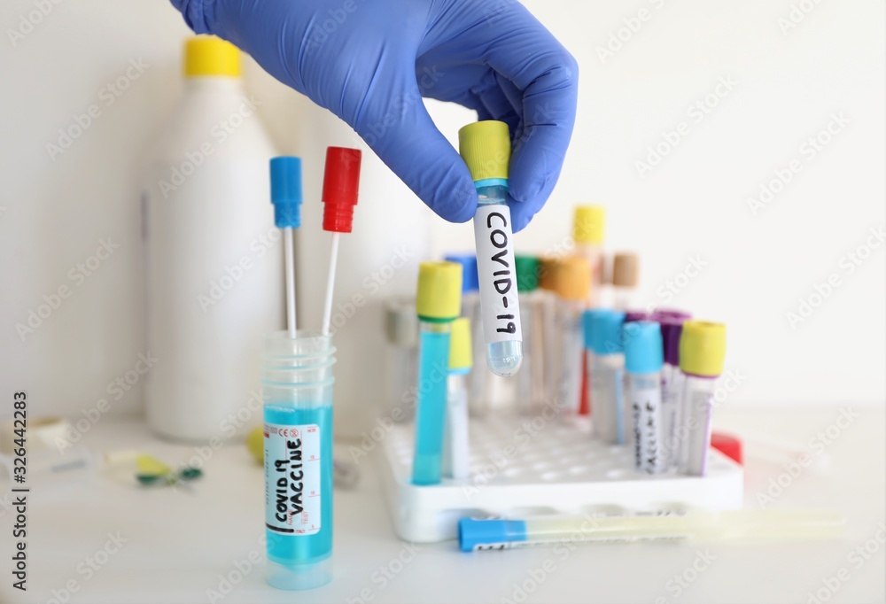 biotechnology laboratory test tubes - coronavirus alert biotechnology laboratory test tubes - coronavirus alert
