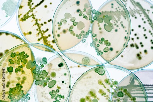 Fotografie Mixed of bacteria colonies and fungus in various petri dish