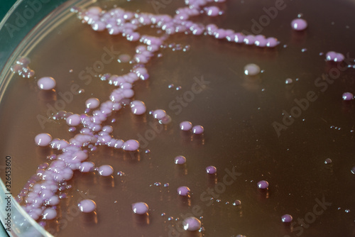 Foto bacterial colonies   on  agar   medium petri dish plate plate on MacConkey agar