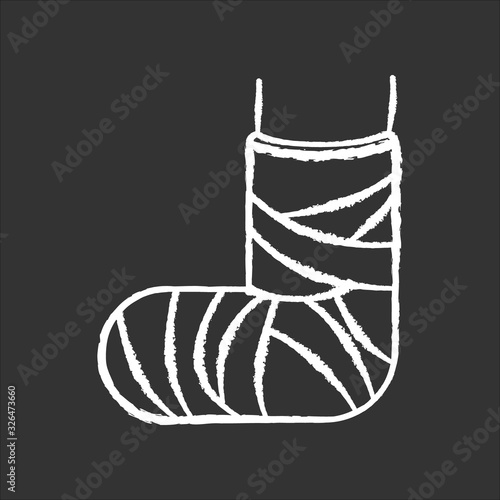Broken foot chalk white icon on black background. Bone fracture. Injured leg in plaster, bandage. Amputated limb. Accident. Hurt joint. Medical condition. Isolated vector chalkboard illustration