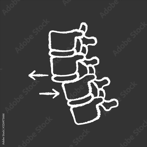 Spine dislocation chalk white icon on black background. Displacement of spinal vertebra. Accident. Spinal injury. Trauma treatment. Medical condition. Isolated vector chalkboard illustration