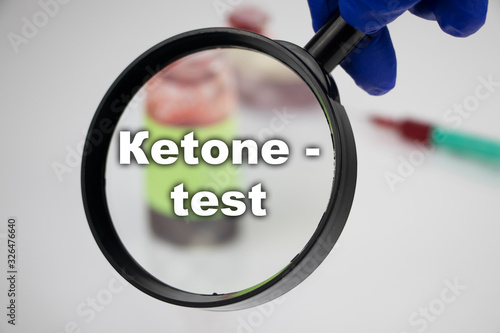 A blood sample for a test for diabetic ketoacidosis (Кetone – test). The doctor’s hand holds a magnifying glass in which a test tube with a blood sample for laboratory research. photo