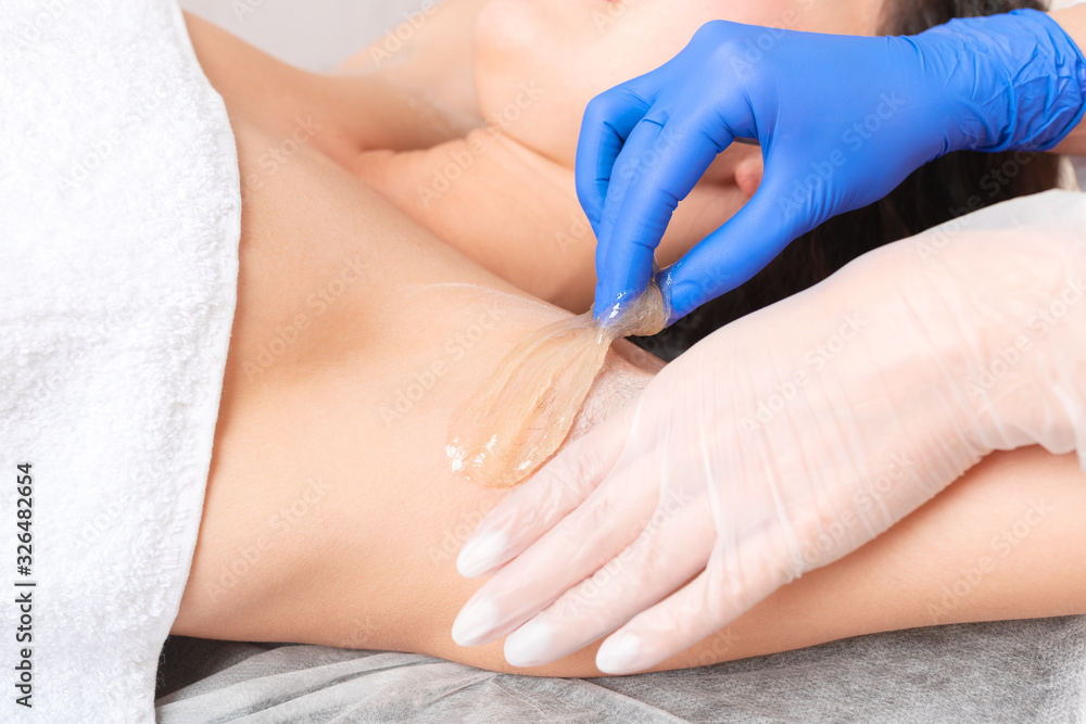Armpit epilation, sugaring or waxing hair removal. Armpit epilation, sugaring or waxing hair removal.