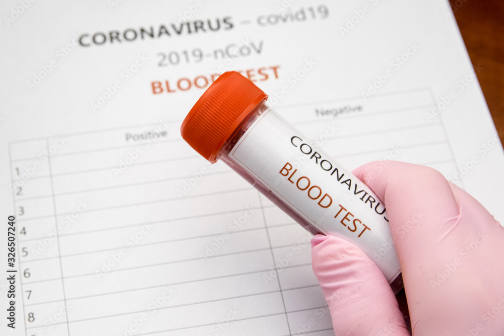 Obraz premium Coronavirus, covid19 - blood test. Test krwi - koronawirus.