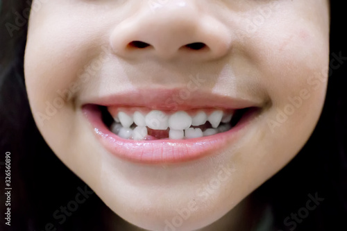 Wallpaper Mural little girl smile losing his first tooth  Torontodigital.ca