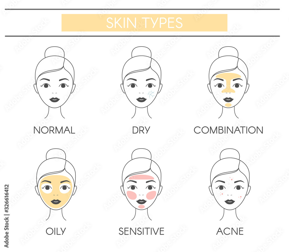 Basic skin types normal, dry, combination, oily, sensitive and acne ...