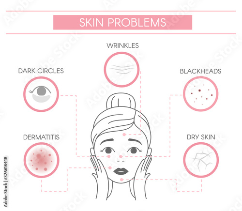Skin problems, dermatitis, dark circles, wrinkles, blackheads, dry skin. Line vector elements on a white background.