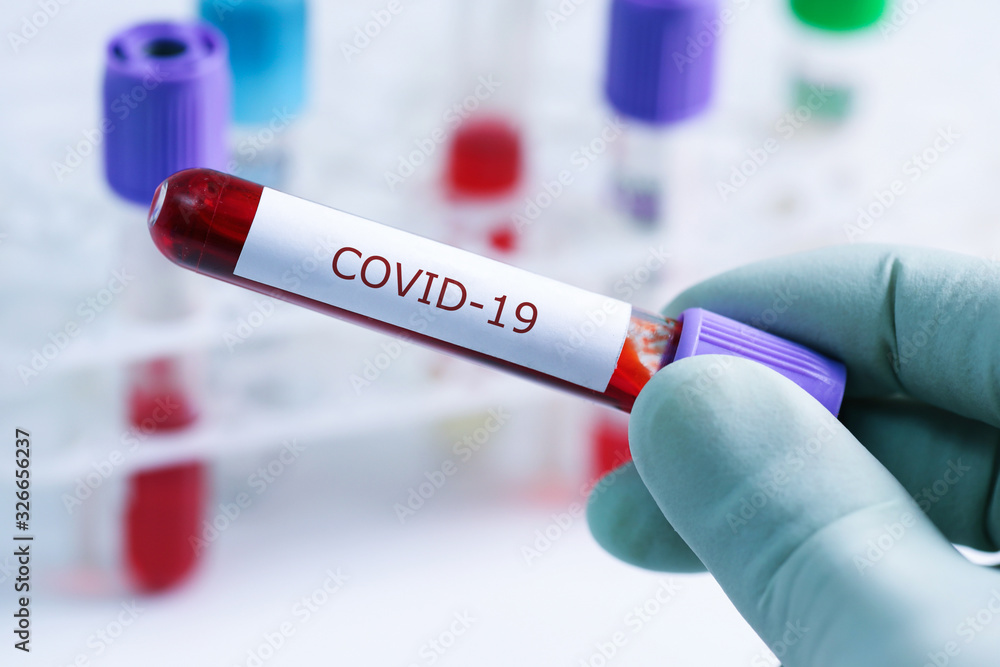 Obraz premium covid-19 - test sample tube with coronavirus in lab
