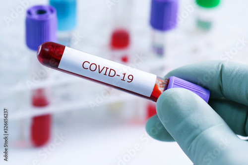 covid-19 - test sample tube with coronavirus in lab photo