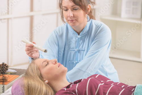 Tableau sur toile Therapist doing moxa treatment