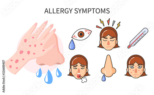 Common symptoms of allergy. Explanation of disease set of isolated icons. Fever and running nose, rashes and headache cough. High temperature and influenza illness. Vector in flat style illustration