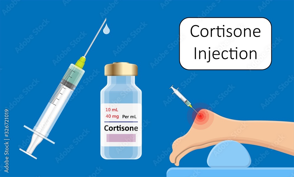 Cortisone shots injection epidural steroid ESI lumbar back spinal
