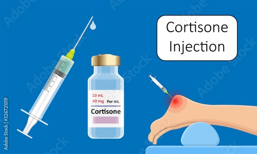 Cortisone shots injection epidural steroid ESI lumbar back spinal nerves anti inflammatory Carpal Tunnel Syndrome tennis elbow symptom swelling chronic discomfort