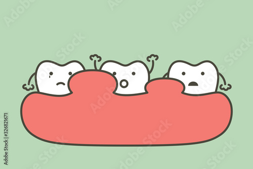 unhealthy teeth because gingivitis or gum disease with abscess, gum is swollen - dental cartoon vector flat style