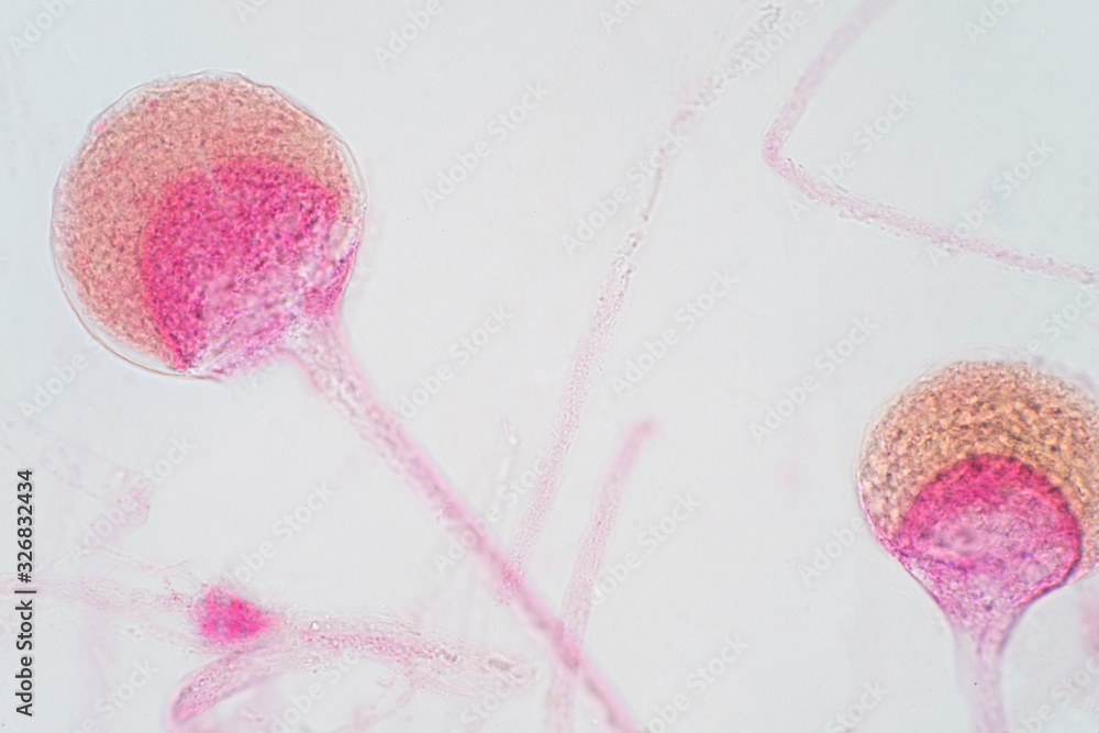 Rhizopus bread mold under the microscope. Stock Photo | Adobe Stock