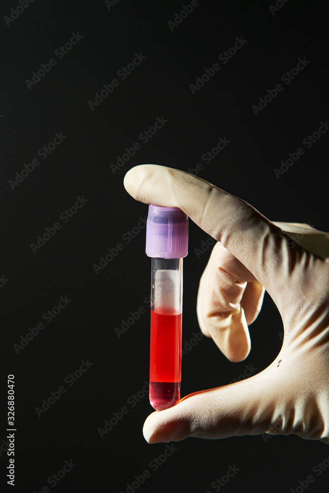 Red liquid in test tube Red liquid in test tube