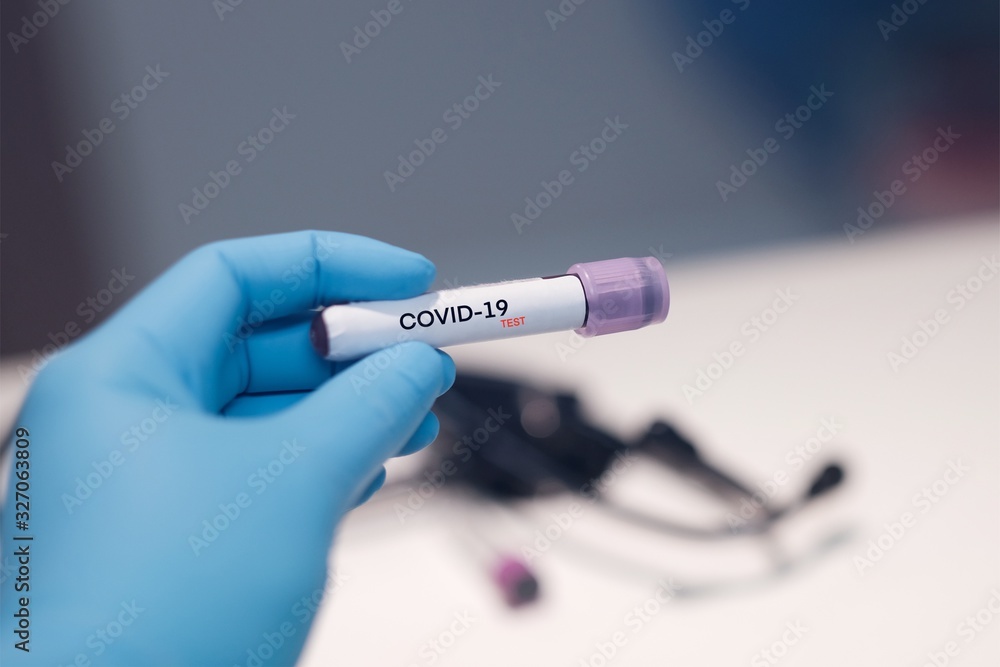 Naklejka premium COVID-19 laboratory blood test coronavirus background concept