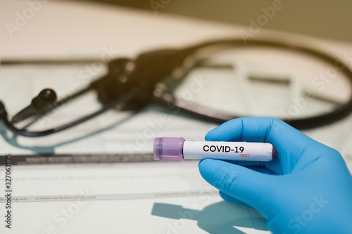 COVID-19 laboratory blood test,coronavirus background concept