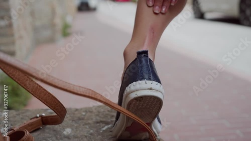 Woman scratched her leg on vacation. Girl in shoes smears healing cream on leg photo